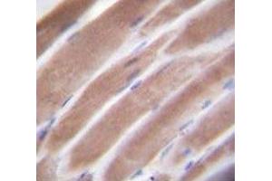IHC testing of VEGFC antibody and FFPE human skeletal muscle. (VEGFC antibody  (AA 20-49))
