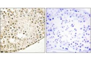 Immunohistochemistry analysis of paraffin-embedded human testis tissue, using SPZ1 Antibody.
