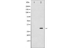 Western blot analysis of TNNI3 phosphorylation expression in Mouse hearttissue lysates,The lane on the left is treated with the antigen-specific peptide. (TNNI3 antibody  (pThr143))