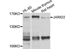 Western blot analysis of extracts of various cells, using JARID2 antibody.