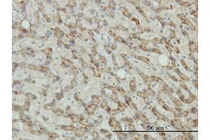 Immunoperoxidase of monoclonal antibody to TYR on formalin-fixed paraffin-embedded human liver tissue. (TYR antibody  (AA 1-377))