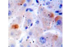 Used in DAB staining on fromalin fixed paraffin-embedded Liver tissue (FAS antibody  (AA 188-319))