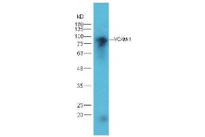 Lane 1: mouse heart lysates probed with Rabbit Anti-VCAM1 Polyclonal Antibody, Unconjugated  at 1:5000 for 90 min at 37˚C. (VCAM1 antibody  (AA 651-739))
