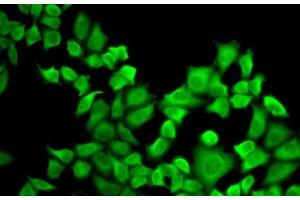 Immunofluorescence analysis of A-549 cells using DHFR Polyclonal Antibody (Dihydrofolate Reductase antibody)