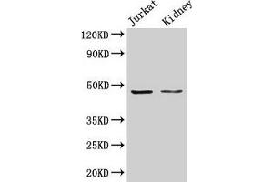 Western Blot Positive WB detected in: Jurkat whole cell lysate, Rat kidney tissue All lanes: ALDOA antibody at 3 μg/mL Secondary Goat polyclonal to rabbit IgG at 1/50000 dilution Predicted band size: 40, 46 kDa Observed band size: 46 kDa (ALDOA antibody  (AA 2-364))