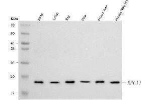Western blot analysis of RPL11 using anti-RPL11 antibody (ABIN7602315).