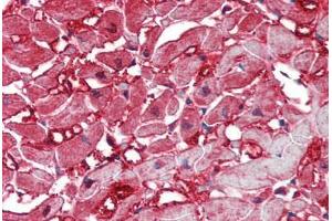 Human Heart: Formalin-Fixed, Paraffin-Embedded (FFPE) (Caspase 12 antibody)