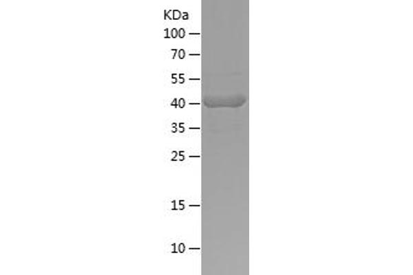 MYH4 Protein (AA 145-329) (His-IF2DI Tag)