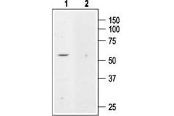 KCNK5 antibody  (Intracellular)