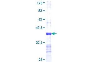 AKR1D1 Protein (AA 227-326) (GST tag)
