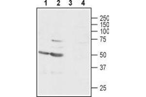 Western blot analysis of rat (lanes 1 and 3) and mouse (lanes 2 and 4) brain lysates: - 1,2. (GABRg1 antibody  (C-Term, Intracellular))