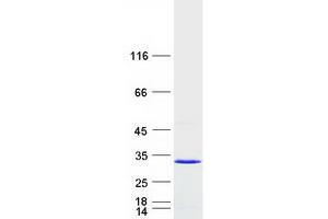 Western Blotting (WB) image for RAB14, Member RAS Oncogene Family (RAB14) protein (Myc-DYKDDDDK Tag) (ABIN2730275)