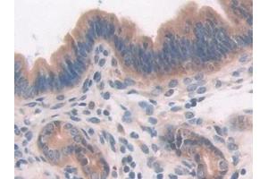 Detection of DEP1 in Mouse Uterus Tissue using Polyclonal Antibody to Density Enhanced Phosphatase 1 (DEP1)