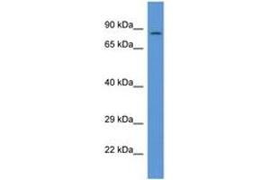Image no. 1 for anti-Protein Phosphatase 1, Regulatory Subunit 15B (PPP1R15B) (AA 480-529) antibody (ABIN6746882) (PPP1R15B antibody  (AA 480-529))