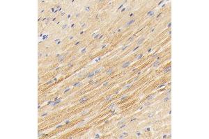 Immunohistochemistry analysis of paraffin embedded mouse heart using PDK3 (ABIN7075334) at dilution of 1: 2000 (PDK3 antibody)