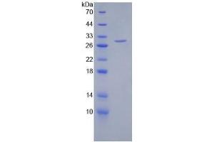 SDS-PAGE of Protein Standard from the Kit  (Highly purified E. (HSPG2 ELISA Kit)