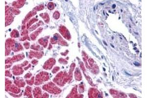 Immunohistochemistry of caspase-12 in human heart tissue with caspase-12 antibody at 10 μg/ml. (Caspase 12 antibody  (N-Term))
