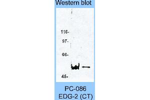 Image no. 1 for anti-Lysophosphatidic Acid Receptor 1 (LPAR1) (C-Term) antibody (ABIN187787) (LPAR1 antibody  (C-Term))