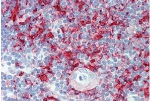 Human Thymus: Formalin-Fixed, Paraffin-Embedded (FFPE) (MHC Class II HLA-DP/DQ/DR antibody)