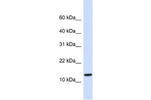 WB Suggested Anti-C1orf95 Antibody Titration:  0. (C1ORF95 antibody  (Middle Region))