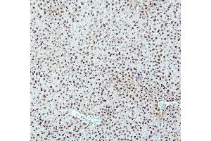 IHC analysis of PTBP2 using anti-PTBP2 antibody (ABIN7599452). (PTBP2 antibody  (AA 1-504))