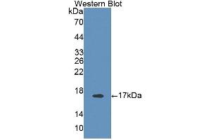 Figure. (Band 3/AE1 antibody  (AA 558-675))