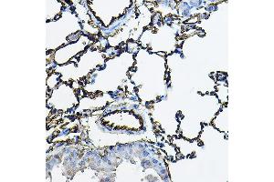 Immunohistochemistry of paraffin-embedded mouse lung using  Rabbit pAb (ABIN3016739, ABIN3016740, ABIN3016741, ABIN1678526 and ABIN6219830) at dilution of 1:100 (40x lens). (Angiotensin I Converting Enzyme 1 antibody  (AA 30-270))