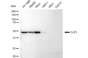 Western blotting analysis using CLP1 antibody (ABIN7798094). (Recombinant CLP1 antibody)