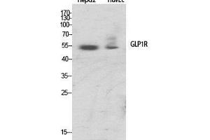 Western Blot (WB) analysis of specific cells using GLP-1R Polyclonal Antibody. (GLP1R antibody  (Internal Region))