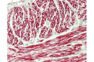 Uterus Myometrium (Desmin antibody)