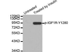 Western blot analysis of extract from 293 cells, using Phospho-IGF1R-Y1280 antibody. (IGF1R antibody  (pTyr1280))