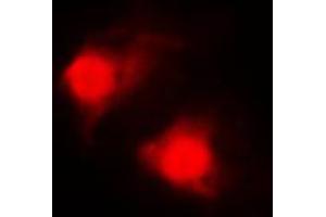 Immunofluorescent analysis of RAR beta staining in MDAMB435 cells. (Retinoic Acid Receptor beta antibody  (C-Term))