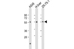 All lanes : Anti-D1 Antibody (N-Term) at 1:2000 dilution Lane 1: A549 whole cell lysate Lane 2: human liver lysate Lane 3: ZR-75-1 whole cell lysate Lysates/proteins at 20 μg per lane. (PM20D1 antibody  (AA 125-159))