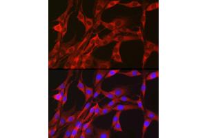 Immunofluorescence analysis of PC-12 cells using PGD Rabbit pAb (ABIN6127314, ABIN6145502, ABIN6145503 and ABIN6223639) at dilution of 1:50 (40x lens). (PGD antibody  (AA 184-483))