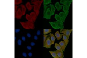 ABIN6265987 and ABIN6276890 staining Hela cells(30 min of UV treatment) by IF/ICC.