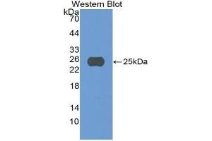 Detection of Recombinant CASP5, Human using Polyclonal Antibody to Caspase 5 (CASP5) (CASP5 antibody  (AA 145-327))