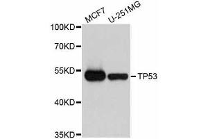 Western blot analysis of extracts of various cell lines, using TP53 antibody. (p53 antibody  (AA 1-110))