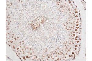 Immunohistochemistry (IHC) image for anti-Microtubule-Associated Protein tau (MAPT) (pSer235) antibody (ABIN6256205)