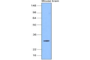 Western Blotting (WB) image for anti-Ubiquitin Carboxyl-terminal Esterase L1 (Ubiquitin Thiolesterase) (UCHL1) antibody (ABIN306421) (UCHL1 antibody)