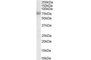 ABIN184623 staining (0. (MTA1 antibody  (Internal Region))