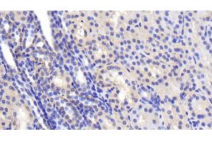 Detection of SPTAN1 in Human Kidney Tissue using Polyclonal Antibody to Alpha-Fodrin (SPTAN1) (SPTAN1 antibody  (AA 1573-1742))