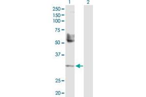 Western Blot analysis of TREX1 expression in transfected 293T cell line by TREX1 MaxPab polyclonal antibody. (TREX1 antibody  (AA 1-304))