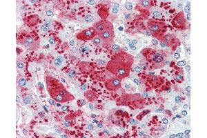 Anti-CDCP1 antibody IHC of human liver. (CDCP1 antibody  (Internal Region))