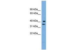 Image no. 1 for anti-Proline Rich Nuclear Receptor Coactivator 1 (PNRC1) (AA 179-228) antibody (ABIN6744955) (PNRC1 antibody  (AA 179-228))