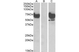 HEK293 lysate (10ug protein in RIPA buffer) overexpressing Human EPM2AIP1 with DYKDDDDK tag probed with ABIN5539636 (1ug/ml) in Lane A and probed with anti-DYKDDDDK Tag (1/1000) in lane C. (EPM2AIP1 antibody  (Internal Region))