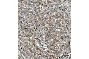 anti-Thrombospondin 3 (THBS3) (AA 23-486) antibody