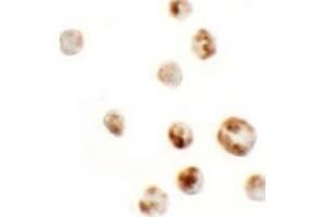 Immunohistochemistry (IHC) image for anti-Actin Filament Associated Protein 1-Like 1 (AFAP1L1) (N-Term) antibody (ABIN1031218) (AFAP1L1 antibody  (N-Term))