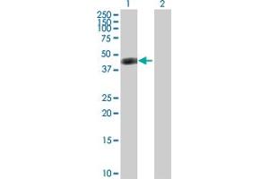 Western Blot analysis of ASL expression in transfected 293T cell line by ASL MaxPab polyclonal antibody. (ASL antibody  (AA 1-464))