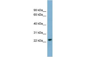 WB Suggested Anti-KLRC3 Antibody Titration:  0.