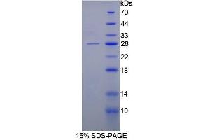 SDS-PAGE (SDS) image for Keratin 8 (KRT8) (AA 92-393) protein (His tag) (ABIN1080168) (KRT8 Protein (AA 92-393) (His tag))